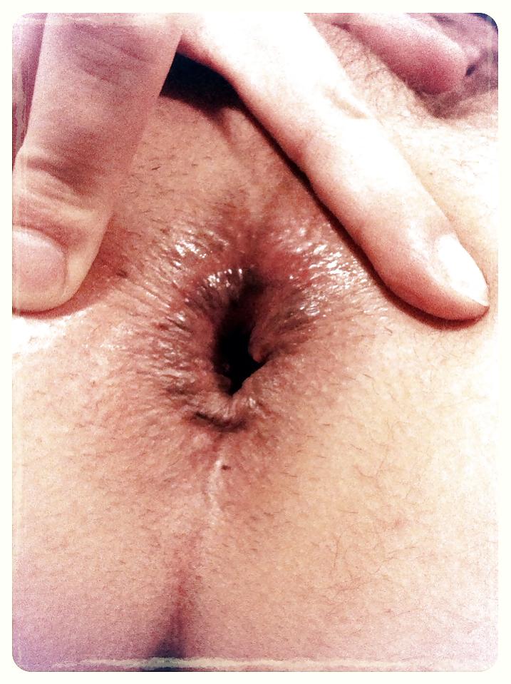 16P My asshole
