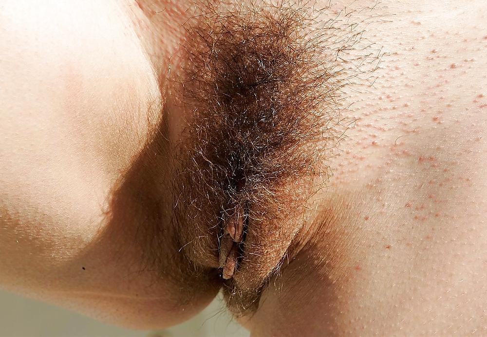25P From the Moshe Files: Hirsute Is Beautiful