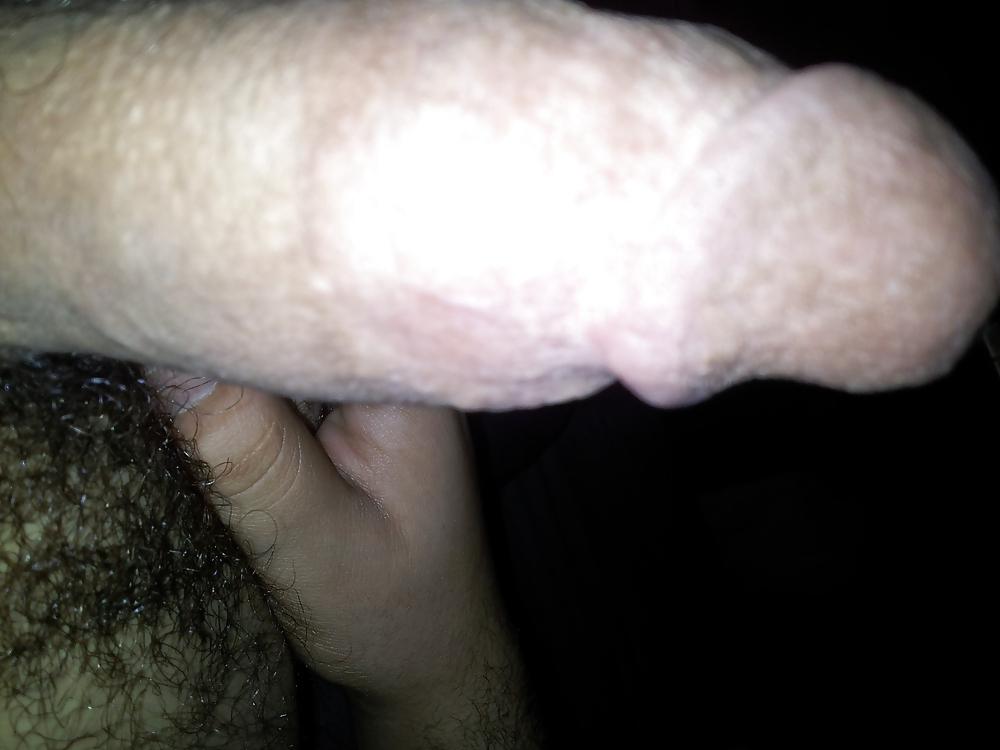 11P Little penis
