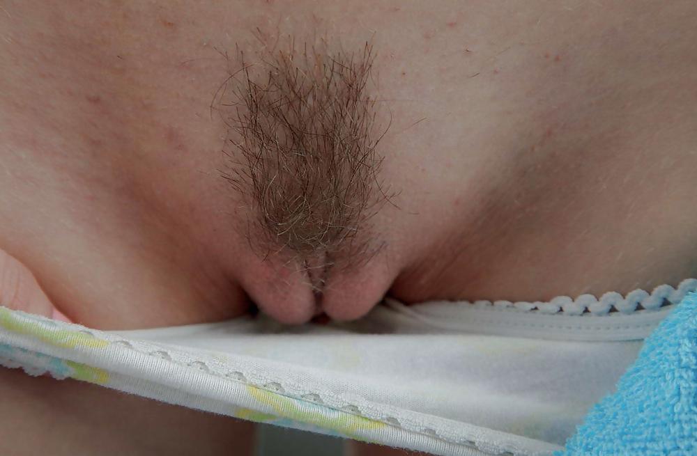 25P From the Moshe Files: Flash Us Your Hairy Teen Twat