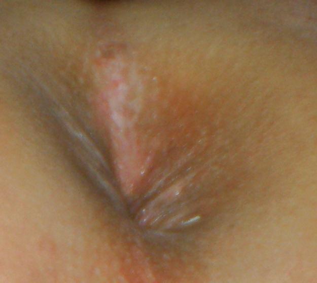 25P Teen girls butthole again