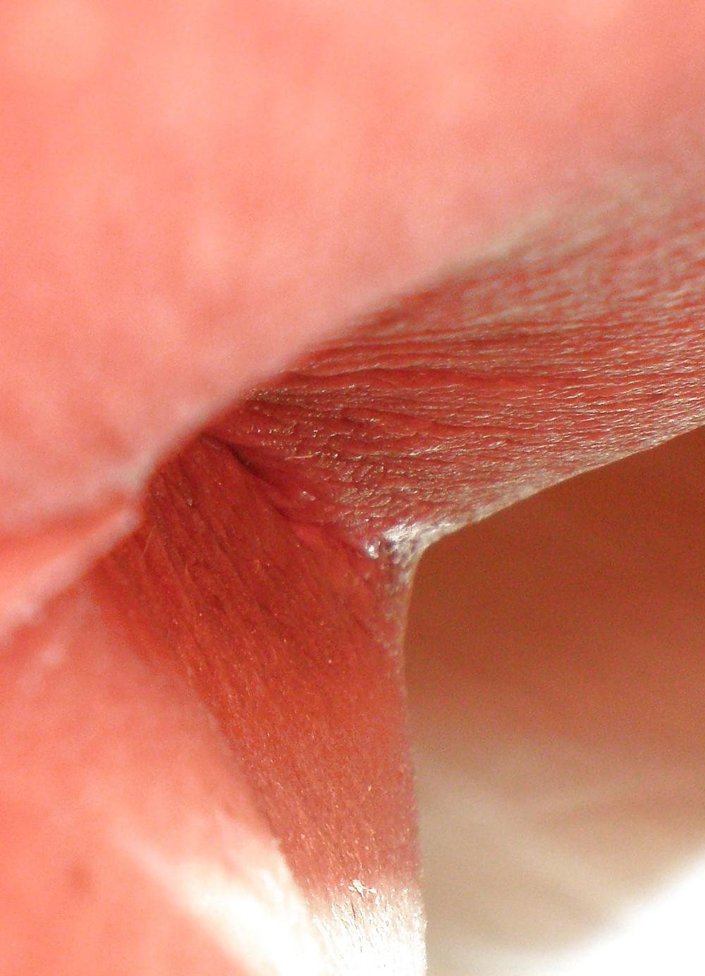 25P Teen girls butthole again