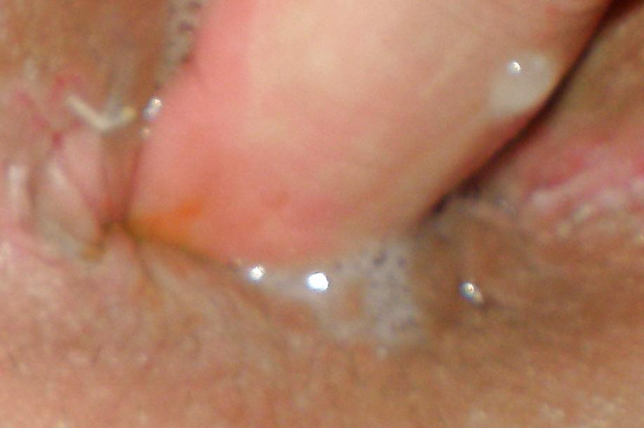 25P Teen girls butthole again