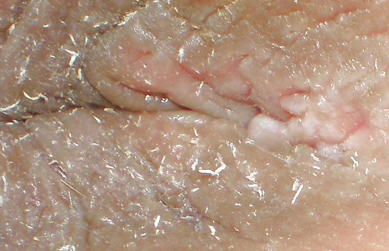 25P Teen girls butthole again