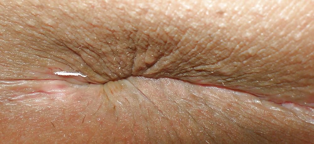 25P Teen girls butthole again
