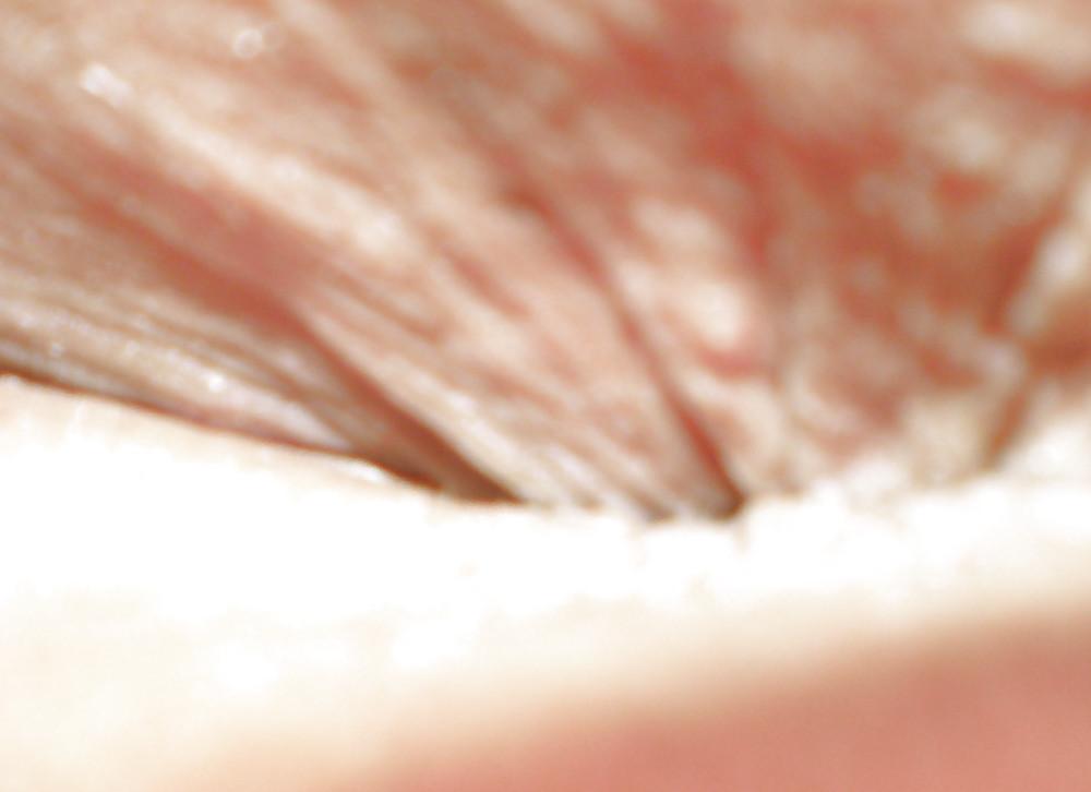 25P Teen girls butthole again