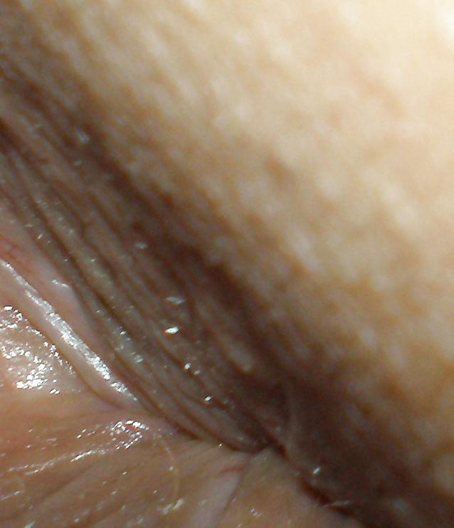 25P Teen girls butthole again