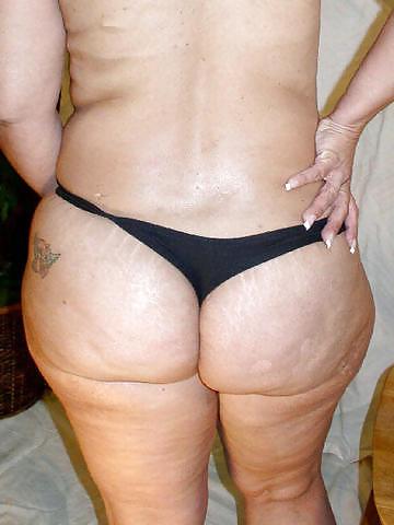 25P For Cellulite Lovers Only