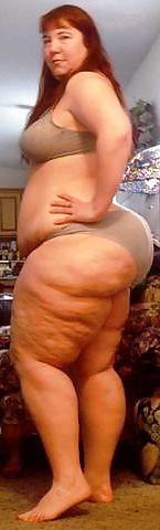 25P For Cellulite Lovers Only