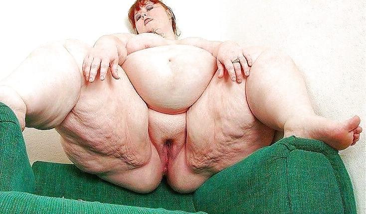 25P For Cellulite Lovers Only