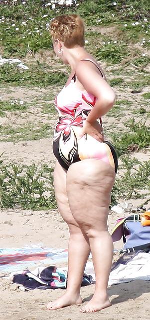 25P For Cellulite Lovers Only