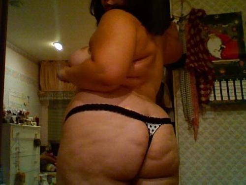 25P For Cellulite Lovers Only