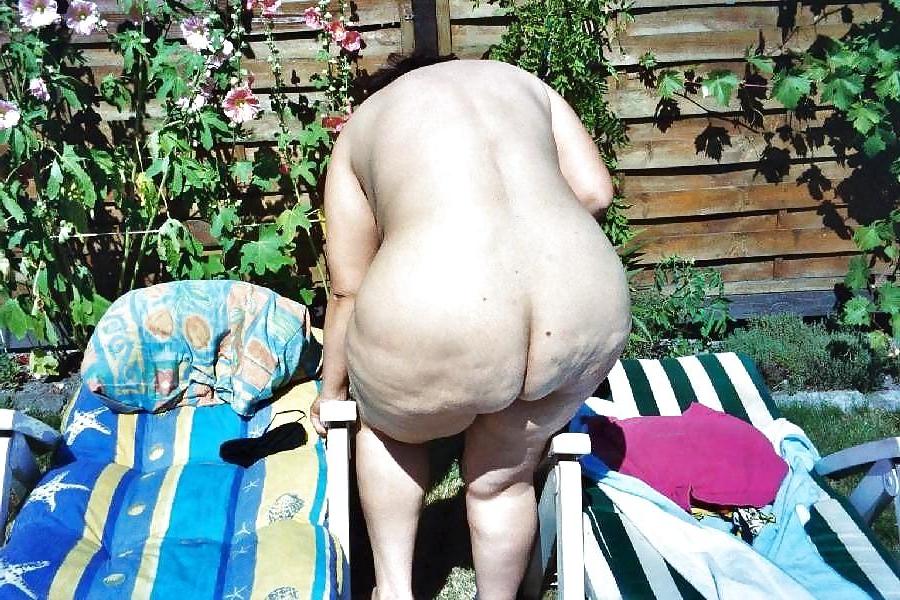 25P For Cellulite Lovers Only