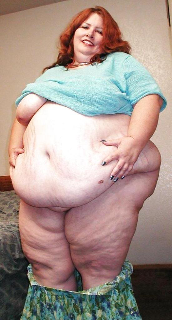 25P For Cellulite Lovers Only