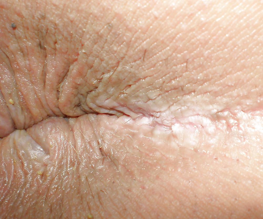 25P My girlie butthole as 18 y 3 m old