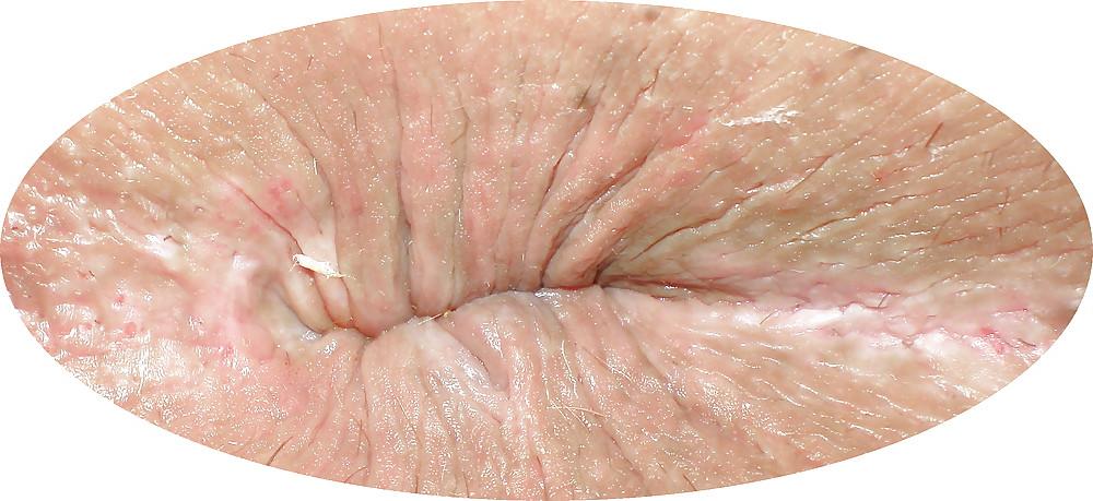25P My girlie butthole as 18 y 3 m old