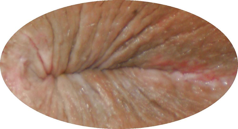 25P My girlie butthole as 18 y 3 m old