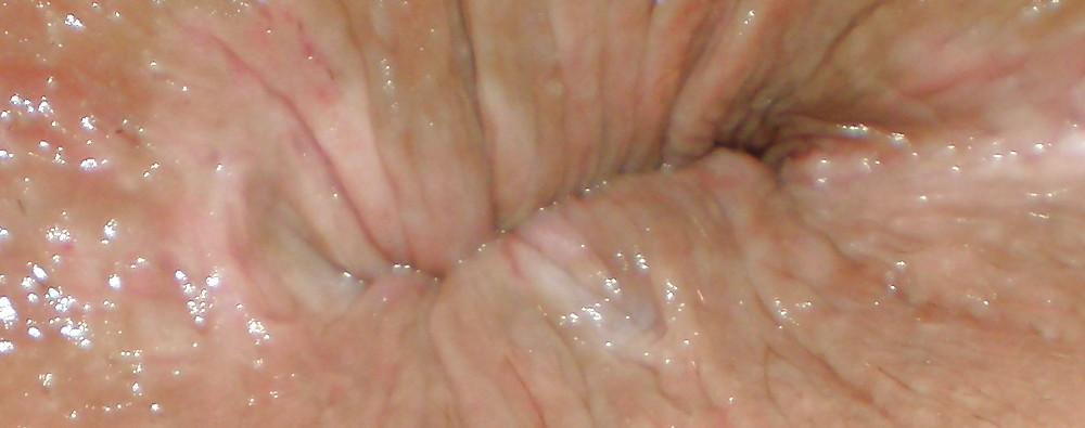 25P My girlie butthole as 18 y 3 m old