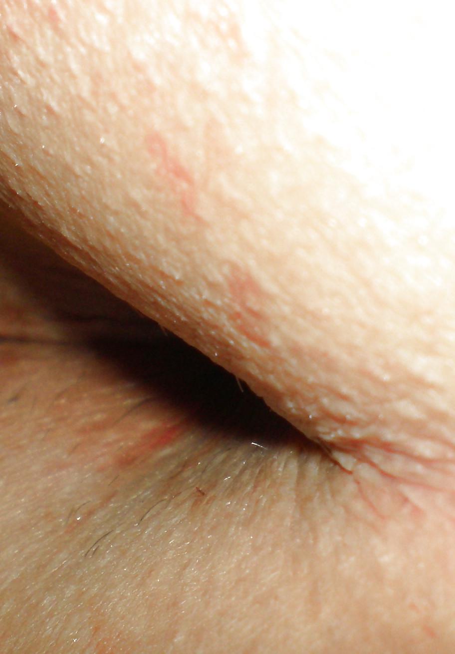 25P My girlie butthole as 18 y 3 m old