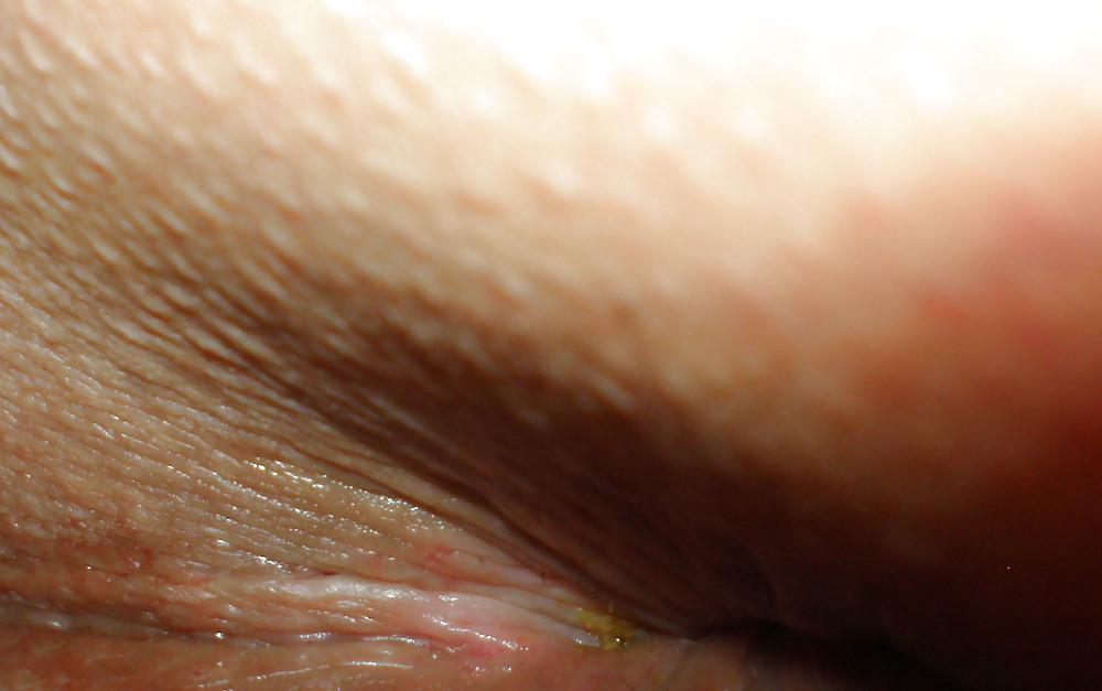 25P My girlie butthole as 18 y 3 m old