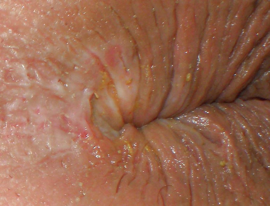 25P My girlie butthole as 18 y 3 m old