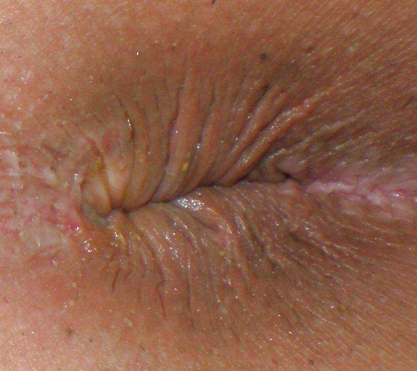 25P My girlie butthole as 18 y 3 m old