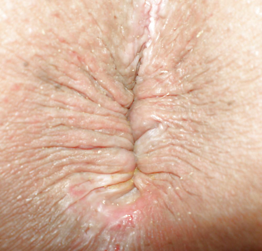 25P My girlie butthole as 18 y 3 m old