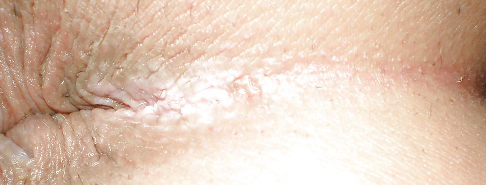 25P My girlie butthole as 18 y 3 m old