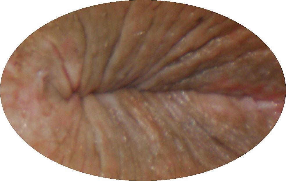 25P My girlie butthole as 18 y 3 m old