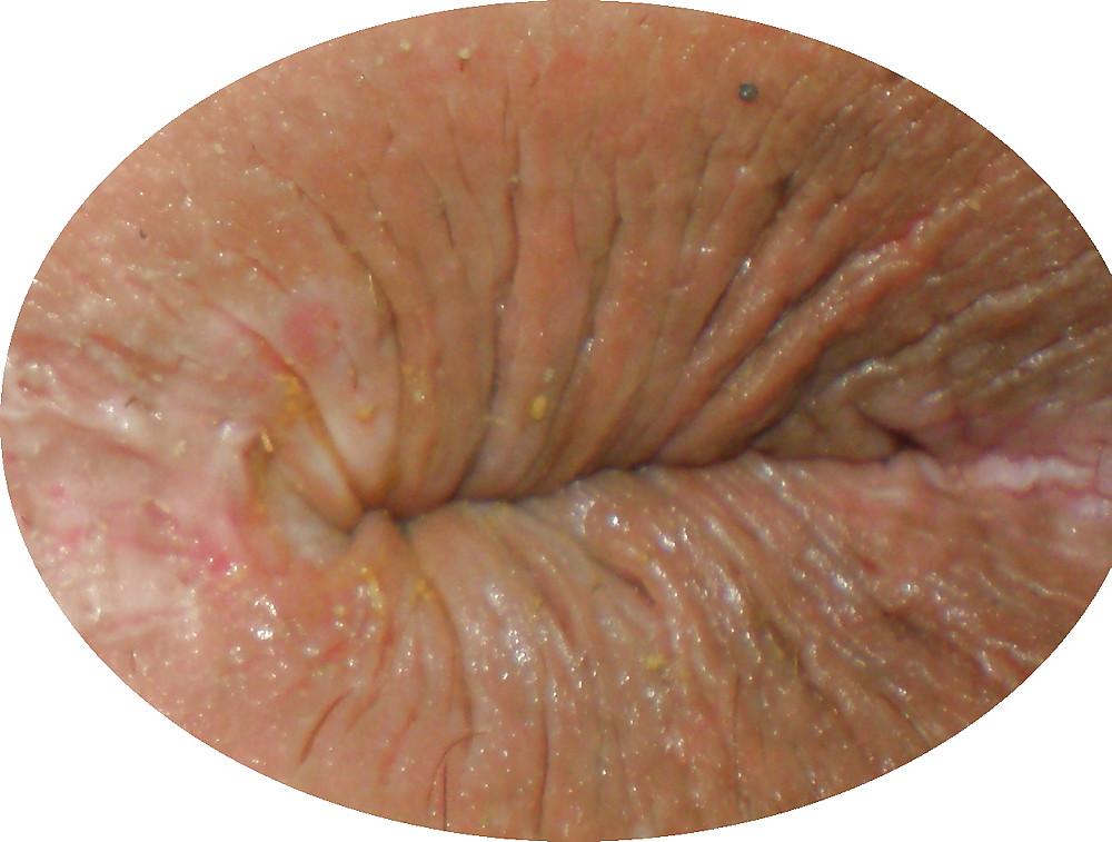 25P My girlie butthole as 18 y 3 m old
