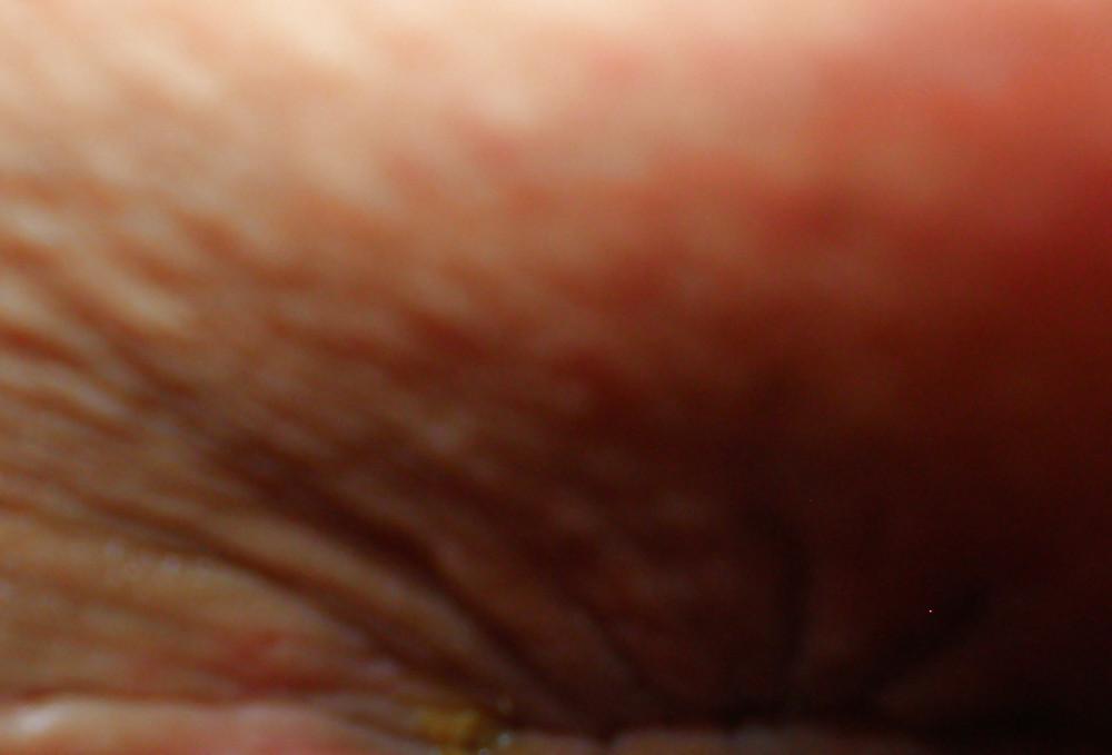 25P My girlie butthole as 18 y 3 m old
