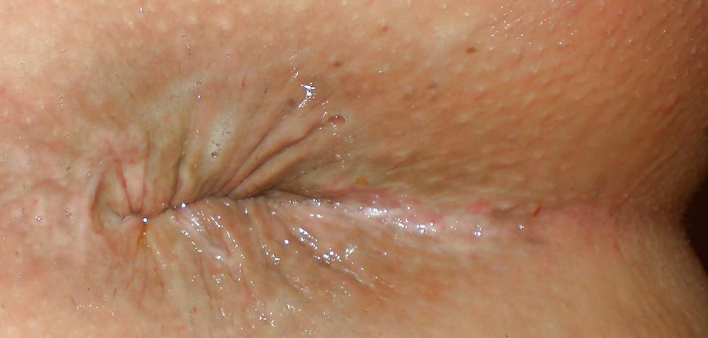 25P My girlie butthole as 18 y 3 m old
