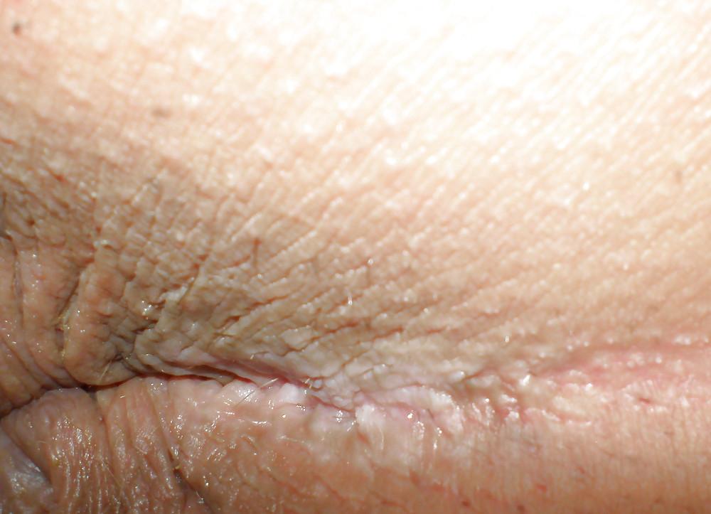 25P My girlie butthole as 18 y 3 m old