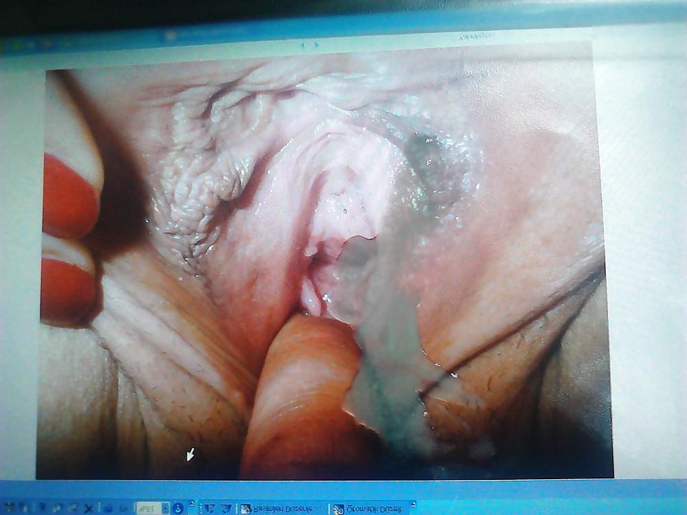 7P Alet sik yarak penis cock dick sperm bosalma cum