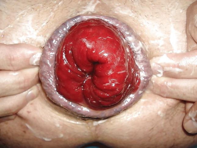 24P Big Asshole