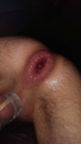 24P Big Asshole