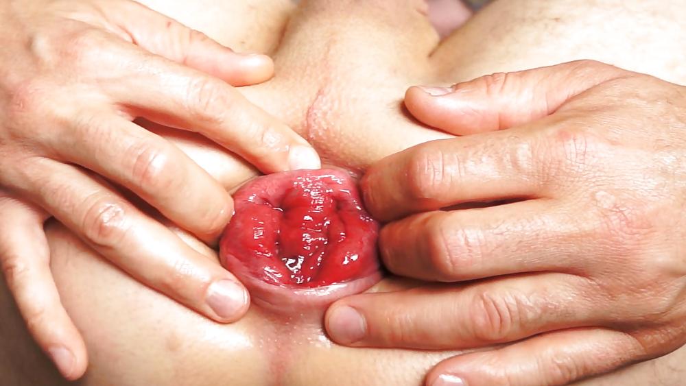 13P Prolapse and rosebutt my gaping asshole june 2013