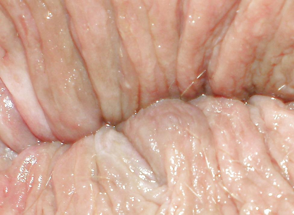 23P Some new girlie butthole closeups from me Amanda 19 yo