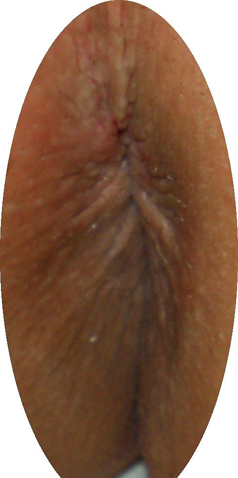 23P Some new girlie butthole closeups from me Amanda 19 yo