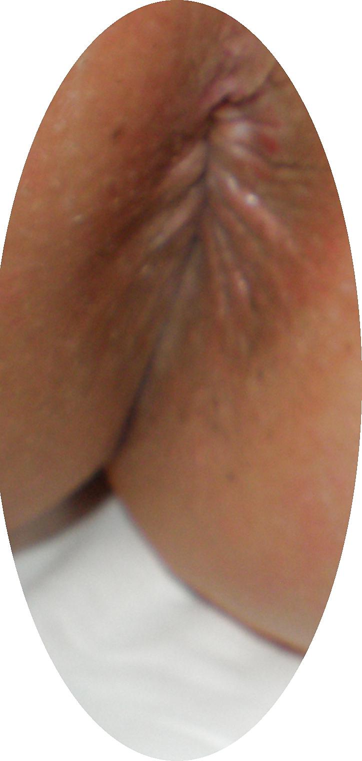 23P Some new girlie butthole closeups from me Amanda 19 yo