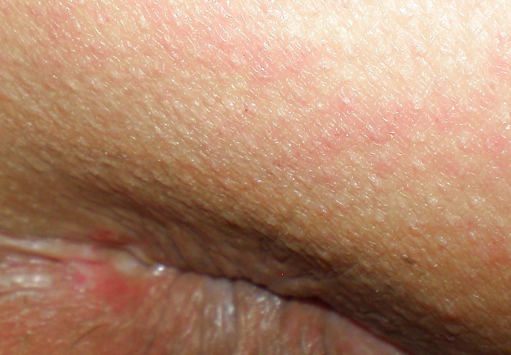 23P Some new girlie butthole closeups from me Amanda 19 yo