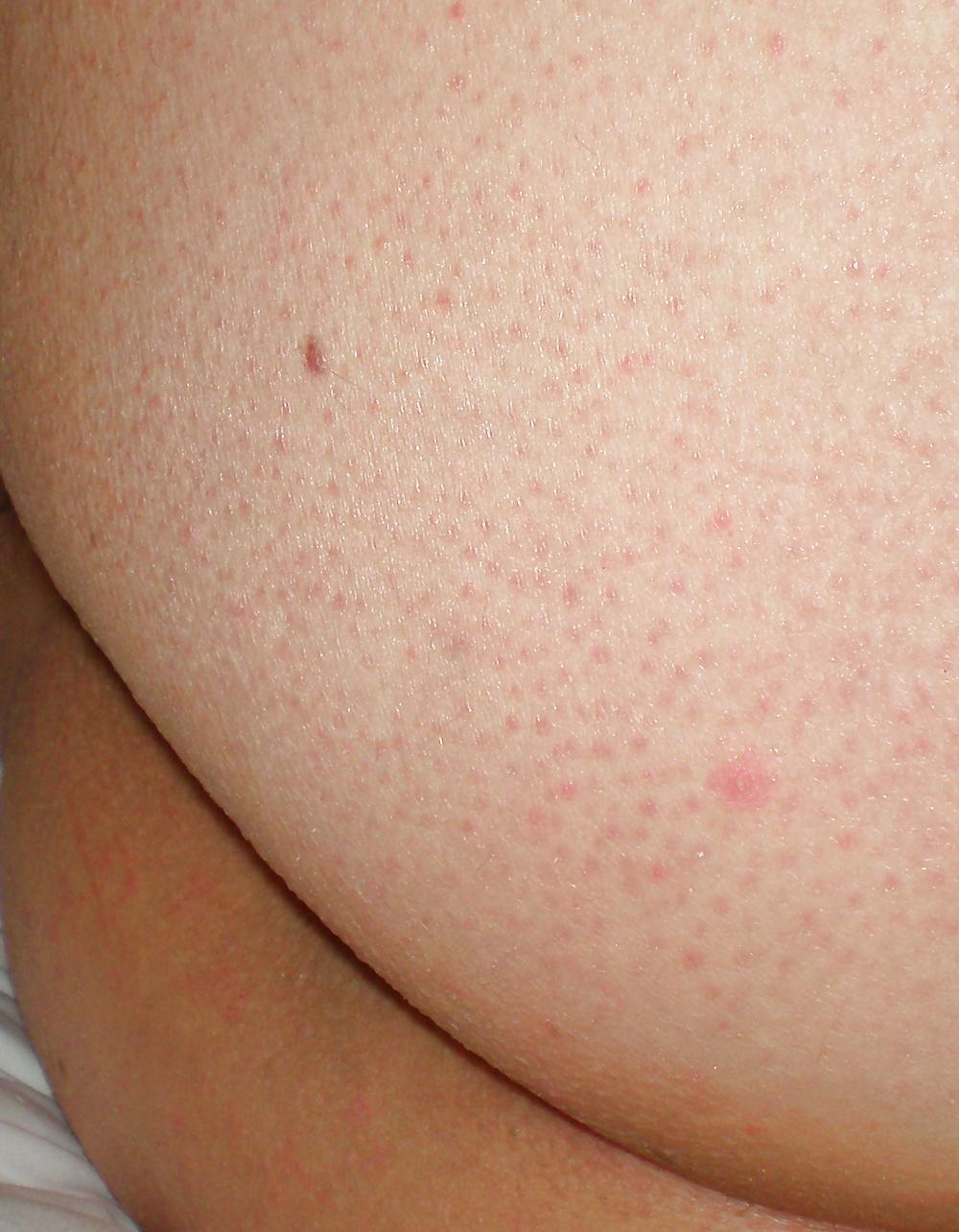 23P Some new girlie butthole closeups from me Amanda 19 yo