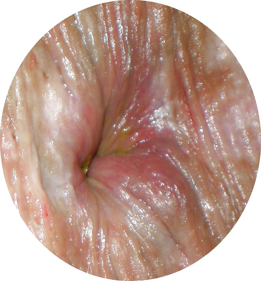 23P Some new girlie butthole closeups from me Amanda 19 yo