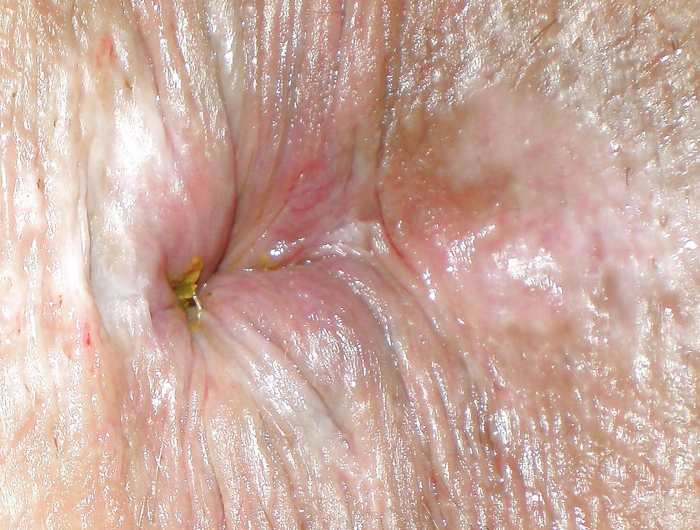 23P Some new girlie butthole closeups from me Amanda 19 yo