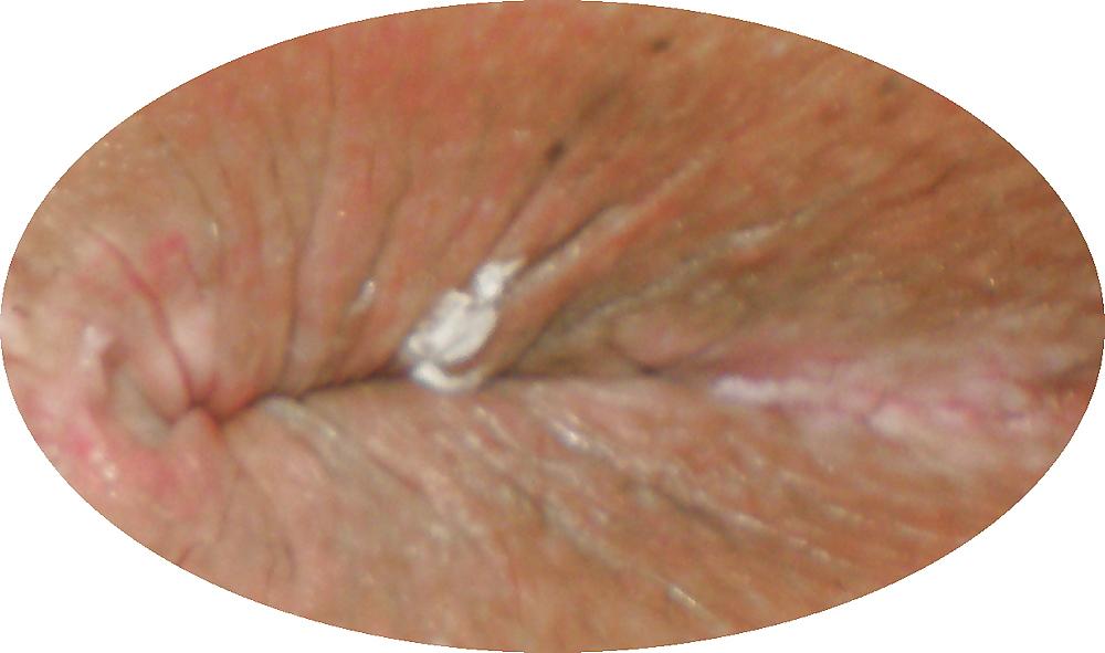 23P Some new girlie butthole closeups from me Amanda 19 yo