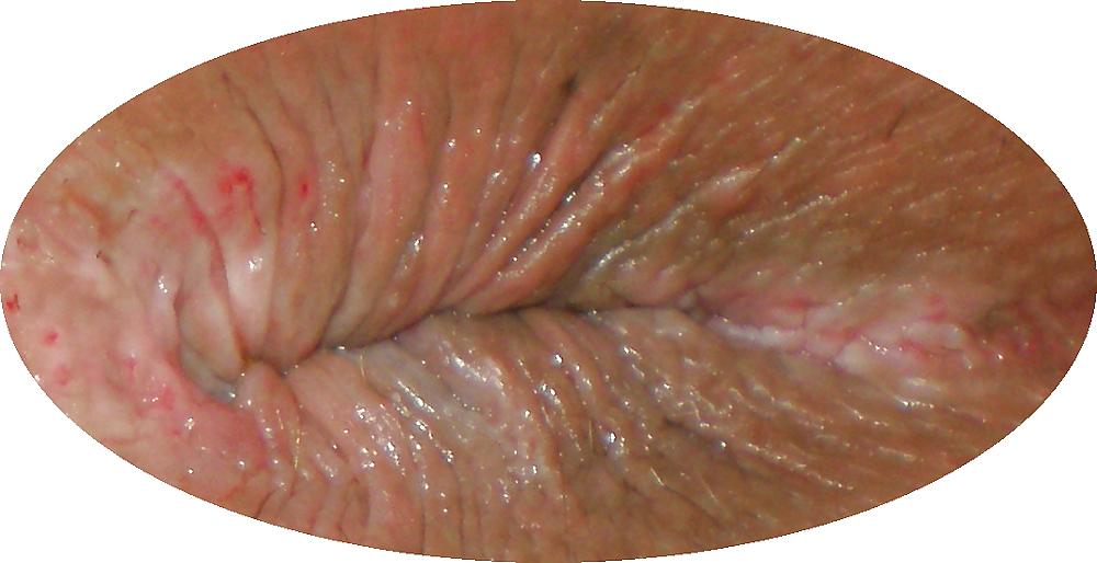23P Some new girlie butthole closeups from me Amanda 19 yo
