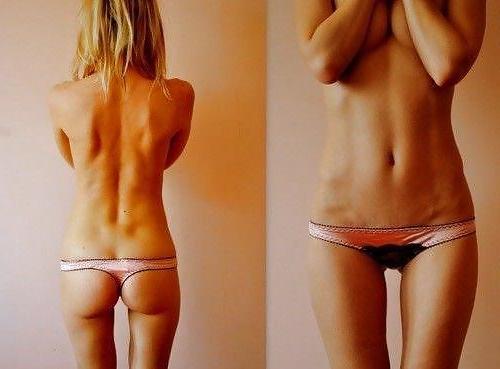 25P Girls with Gaps