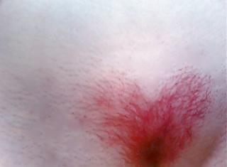 25P Dyed Colered Pubes