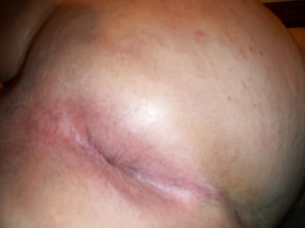 9P My butthole