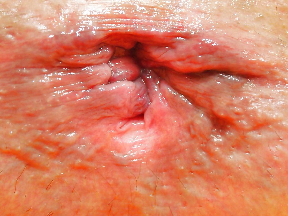 25P Il Buco del Culo - The Asshole